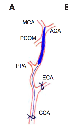 Intraluminal Suture Model